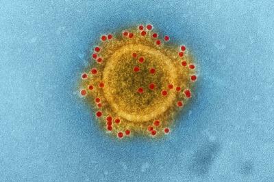 Coronavírus: MA tem mais de 120 mil casos confirmados