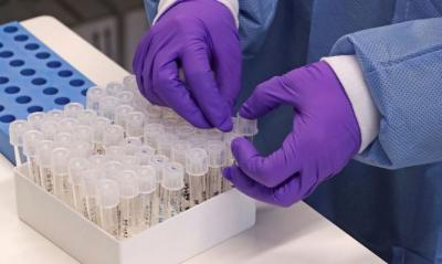 Sancionada lei que prioriza testes para profissionais essenciais