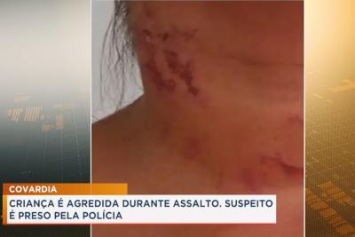 Preso suspeito de agredir criança de 8 anos em assalto