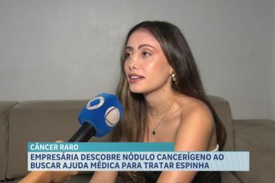 Empresária maranhense descobre câncer em tratamento contra espinhas