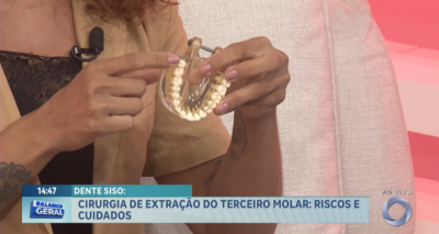 Vem Comigo: Saiba mais sobre a cirurgia de extração do terceiro molar