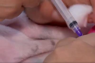 Maranhão registra caso de sarampo após anos sem ocorrências