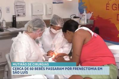 Mutirão realiza cerca de 60 cirurgias de frenectomia em recém-nascidos em São Luís
